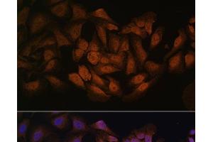 Immunofluorescence analysis of U-2 OS cells using CNBP Polyclonal Antibody at dilution of 1:100. (CNBP anticorps)