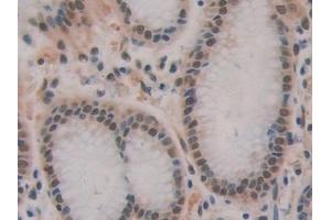 Detection of BCAS3 in Human Stomach Tissue using Polyclonal Antibody to Breast Carcinoma Amplified Sequence 3 (BCAS3)