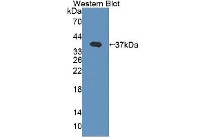 Figure. (EPB41 anticorps  (AA 210-497))