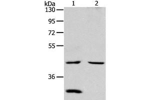Western Blot analysis of Mouse kidney and heart tissue using NCEH1 Polyclonal Antibody at dilution of 1:1300 (NCEH1 anticorps)