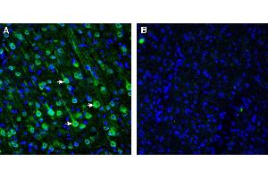 anti-Solute Carrier Family 47, Member 1 (SLC47A1) (AA 496-509), (Extracellular) antibody