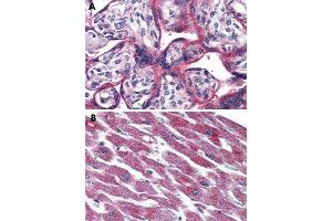 Immunohistochemical staining of formalin-fixed, paraffin-embedded human placenta (A) and human heart (B) tissue after heat-induced antigen retrieval. (ADCYAP1R1 anticorps  (Extracellular Domain))
