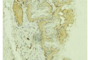 ABIN6274083 at 1/100 staining Mouse colon tissue by IHC-P. (PDLIM1 anticorps  (Internal Region))