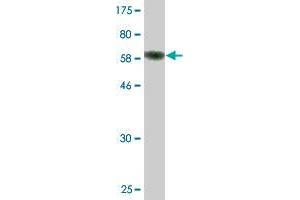 Western Blot detection against Immunogen (60. (FBXO8 anticorps  (AA 1-319))