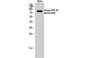 Western Blotting (WB) image for anti-Heat Shock Protein 90 (HSP90) (acLys284), (acLys292) antibody (ABIN3172835) (HSP90 anticorps  (acLys284, acLys292))