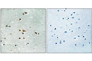 Immunohistochemical analysis of paraffin-embedded human brain tissue using FER (Phospho-Tyr402) antibody (left)or the same antibody preincubated with blocking peptide (right).