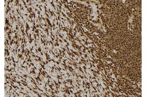 ABIN6277516 at 1/100 staining Human gastric tissue by IHC-P.