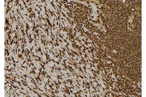 ABIN6277516 at 1/100 staining Human gastric tissue by IHC-P. (NDRG2 anticorps  (C-Term))