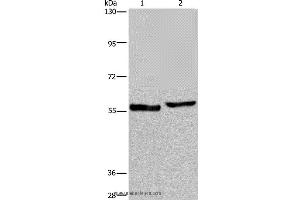 Western blot analysis of Human testis tissue and A375 cell, using SLC1A6 Polyclonal Antibody at dilution of 1:400 (SLC1A6 anticorps)