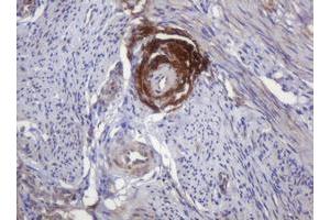 Image no. 3 for anti-Parvin, beta (PARVB) antibody (ABIN1496912)