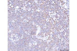 IHC analysis of PLCG 2/PLCG2 using anti-PLCG 2/PLCG2 antibody (ABIN5692854). (Phospholipase C gamma 2 anticorps  (AA 1201-1258))