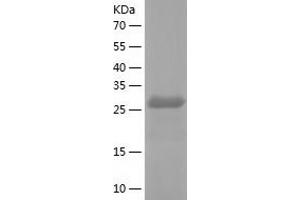 Western Blotting (WB) image for Sepiapterin Reductase (SPR) (AA 1-261) protein (His-IF2DI Tag) (ABIN7125023)