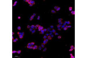 Immunocytochemistry analysis of 4 % paraformaldehyde-fixed MCF-7 cells using COX5B (ABIN7073665) at dilution of 1: 1000 (200x lens)