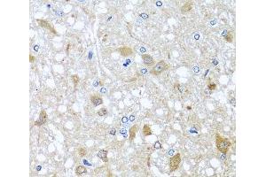 Immunohistochemistry of paraffin-embedded Rat brain using EFHC1 Polyclonal Antibody at dilution of 1:100 (40x lens). (EFHC1 anticorps)
