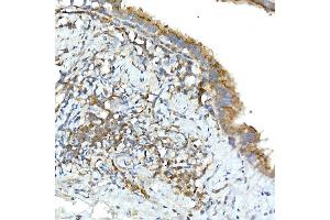 Immunohistochemistry of paraffin-embedded rat lung using TNF Rabbit pAb (ABIN3022984, ABIN3022985, ABIN3022986 and ABIN6219332) at dilution of 1:50 (40x lens). (TNFAIP3 anticorps  (AA 1-190))