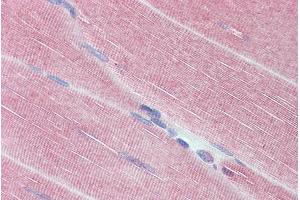 ABIN6391349 (3. (PPP1R12A anticorps  (C-Term))