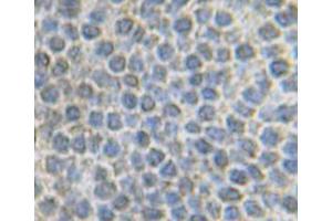 Image no. 3 for anti-Fibroblast Growth Factor 10 (FGF10) antibody (ABIN464942) (FGF10 anticorps)