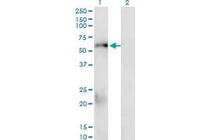 Western Blot analysis of SMAD1 expression in transfected 293T cell line by SMAD1 monoclonal antibody (M02), clone 1D3.