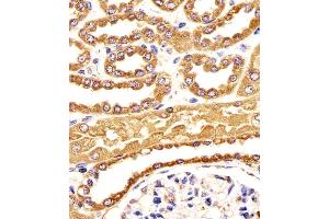 anti-B-Cell Receptor-Associated Protein 31 (BCAP31) (AA 120-147) antibody