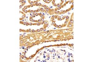 Immunohistochemical analysis of paraffin-embedded H. (BCAP31 anticorps  (AA 120-147))