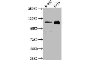 Western Blot Positive WB detected in: K562 whole cell lysate, Hela whole cell lysate All lanes: NUP98 antibody at 1:1000 Secondary Goat polyclonal to rabbit IgG at 1/50000 dilution Predicted band size: 198, 188, 98, 97, 196, 187 kDa Observed band size: 100 kDa (Recombinant NUP98 anticorps)