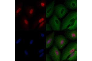 ABIN6259073 and ABIN6273516 staining  cells by IF/ICC. (MSH3 anticorps  (N-Term))