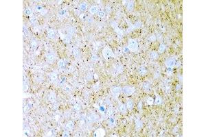 Immunohistochemistry of paraffin-embedded Rat brain using WNT2 Polyclonal Antibody at dilution of 1:200 (40x lens). (WNT2 anticorps)
