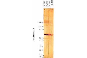 Western Blotting (WB) image for anti-Cytomegalovirus p65 (CMV p65) antibody (ABIN265537) (CMV p65 anticorps)