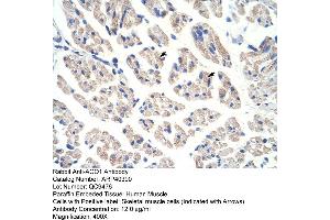 Rabbit Anti-ACO1 Antibody  Paraffin Embedded Tissue: Human Muscle Cellular Data: Skeletal muscle cells Antibody Concentration: 4.