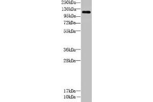 Western Blot All lanes: CCDC103 antibody at 5 μg/mL + Mouse heart tissue Secondary Goat polyclonal to rabbit IgG at 1/10000 dilution Predicted band size: 28, 12 kDa Observed band size: 111 kDa (CCDC13 anticorps  (AA 1-242))