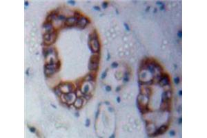 Used in DAB staining on fromalin fixed paraffin-embedded Kidney tissue (Merlin anticorps  (AA 30-311))