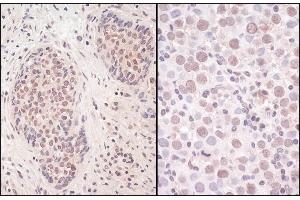 anti-Structural Maintenance of Chromosomes Flexible Hinge Domain Containing 1 (SMCHD1) (AA 1955-2005) antibody