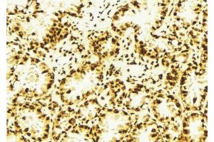 ABIN6277741 at 1/100 staining Human lung tissue by IHC-P. (ASH2L anticorps  (Internal Region))