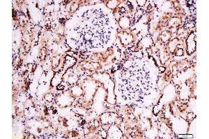 Formalin-fixed and paraffin embedded human kidney labeled with Anti- Pan FOXD Polyclonal Antibody, Unconjugated  at 1:200 followed by conjugation to the secondary antibody and DAB staining. (FOXD (AA 131-230) anticorps)
