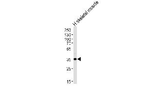 Western blot analysis of lysate from human skeletal muscle tissue lysate, using PPP1R3B Antibody at 1:1000 at each lane. (PPP1R3B anticorps  (C-Term))