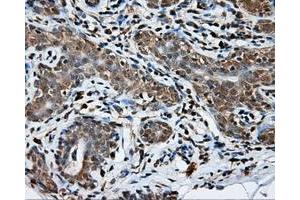 Immunohistochemical staining of paraffin-embedded breast tissue using anti-NPR3 mouse monoclonal antibody. (NPR3 anticorps)