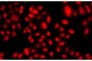 Immunofluorescence analysis of A549 cells using TEAD3 Polyclonal Antibody (TEAD3 anticorps)