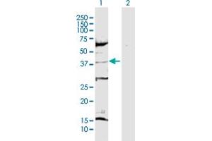 Western Blot analysis of CDK6 expression in transfected 293T cell line by CDK6 MaxPab polyclonal antibody. (CDK6 anticorps  (AA 1-326))