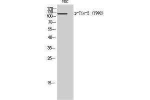Western Blotting (WB) image for anti-TEK Tyrosine Kinase, Endothelial (TEK) (pTyr992) antibody (ABIN3173095) (TEK anticorps  (pTyr992))