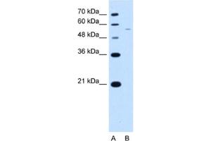 Western Blotting (WB) image for anti-arginine/serine-Rich Coiled-Coil 2 (RSRC2) antibody (ABIN2463413) (RSRC2 anticorps)
