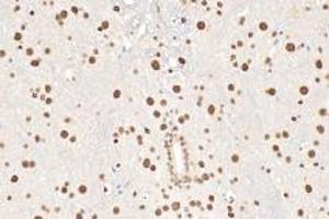 Immunohistochemistry analysis of paraffin-embedded mouse spinal cord using,Ring1A (ABIN7075467) at dilution of 1: 3600