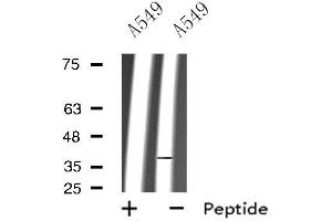 Western blot analysis of extracts from A549 cells, using RHO antibody. (Rho-related GTP-binding protein anticorps)