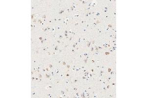 Immunohistochemical analysis of paraffin-embedded human brain tissue using (ABIN6243332 and ABIN6578894) performed on the Leica® BOND RXm.