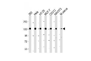All lanes : Anti-Phospho-MYPT1 (Ser507) Antibody: Ctrl at 1:4000 dilution Lane 1: 293 whole cell lysate Lane 2: Hela whole cell lysate Lane 3: HT-29 whole cell lysate Lane 4: MCF-7 whole cell lysate Lane 5: C2C12 whole cell lysate Lane 6: NIH/3T3 whole cell lysate Lane 7: Mouse uterus lysate Lysates/proteins at 20 μg per lane. (PPP1R12A anticorps  (Ser507))
