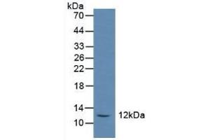 Detection of SST in Rat Serum using Polyclonal Antibody to Somatostatin (SST)