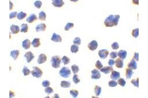 Immunocytochemistry of CTRP7 in 293 cells with AP30260PU-N CTRP7 antibody at 10 μg/ml. (CTRP7 anticorps)