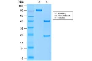 SDS-PAGE analysis of purified, BSA-free recombinant TRAcP antibody (clone rACP5/1070) as confirmation of integrity and purity. (ACP5 anticorps)