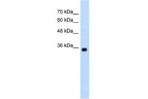 WB Suggested Anti-ZMYND11 Antibody Titration:  1. (ZMYND11 anticorps  (N-Term))