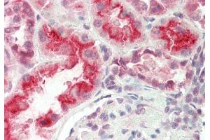 Rabbit Anti-SLC7A7 antibody  Formalin Fixed Paraffin Embedded Tissue: Human Kidney Primary antibody Concentration: 1:100 Secondary Antibody: Donkey anti-Rabbit-Cy3 Secondary Antibody Concentration: 1:200 Magnification: 20x Exposure Time: 0.