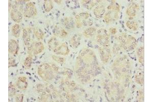 Immunohistochemistry of paraffin-embedded human salivary gland tissue using ABIN7173912 at dilution of 1:100
